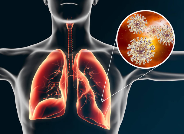 İnsan ciğerlerinde koronavirüs; zatürree, 3 boyutlu illüstrasyon - Fotoğraf, Görsel