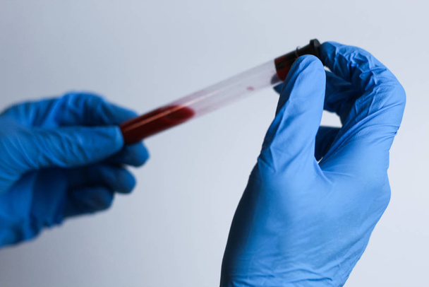 naukowiec w niebieskich rękawiczkach trzyma rurkę do badań krwi do analizy testu koronawirusowego - Zdjęcie, obraz