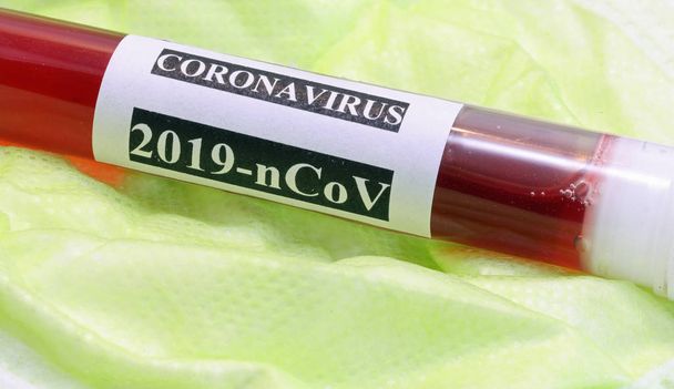 test tube with blood for the control of the deadly coronavirus - Photo, Image