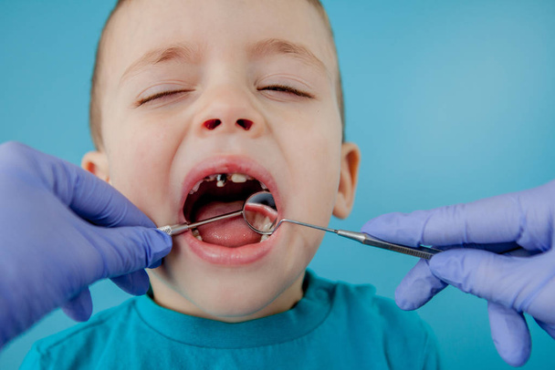 Close up of dentist's hands with assistant in blue gloves are treating teeth to a child, patient's face is closed - Zdjęcie, obraz