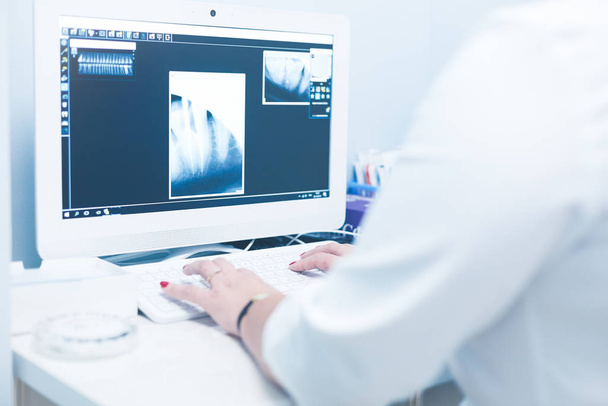 Egy női orvos, aki röntgent néz és laptopot használ a kórházban. - Fotó, kép