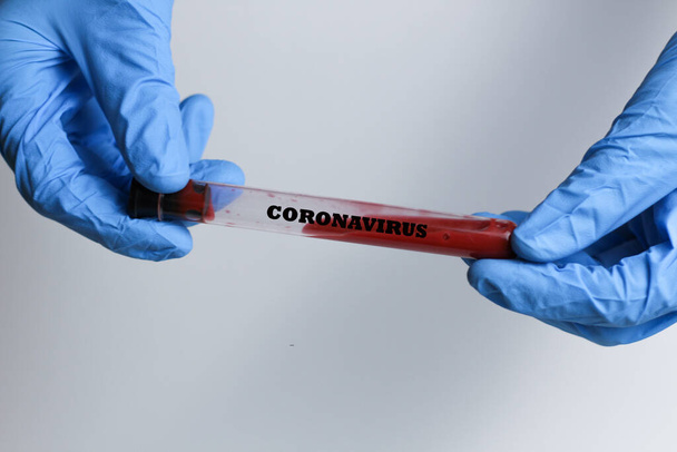Koncept koronavirových krevních testů. Lékařská ruka v bílé lékařské rukavici drží zkumavku s koronavirem pozitivní krví v laboratoři. 2019-ncov Coronavirus původem z Wuhan, Čína - Fotografie, Obrázek