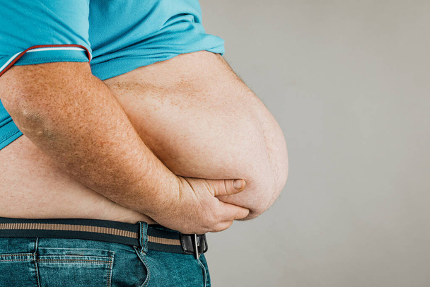Sovrappeso del corpo di una persona con mani che toccano l'addome. T
 - Foto, immagini