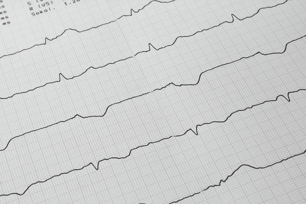 Heartbeat Cardiology Ecg, ambulance service - Foto, imagen