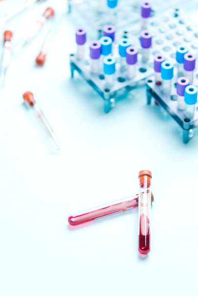 Blood sample tube vials near the rake with medical samples, medical analysis laboratory - Fotografie, Obrázek