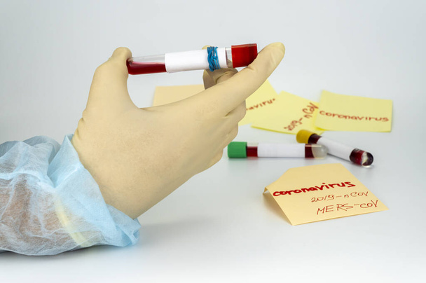 Muestra de sangre de mano en tubo de vacío. Resultado positivo de la prueba para el nuevo Coronavirus de rápida propagación
 - Foto, imagen