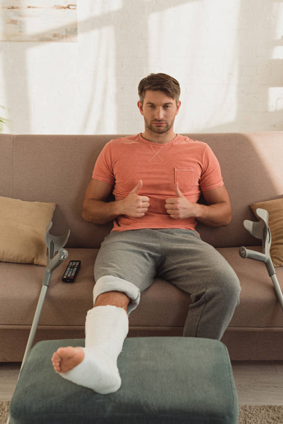 Handsome man with leg in plaster bandage showing thumbs up on couch - Фото, зображення