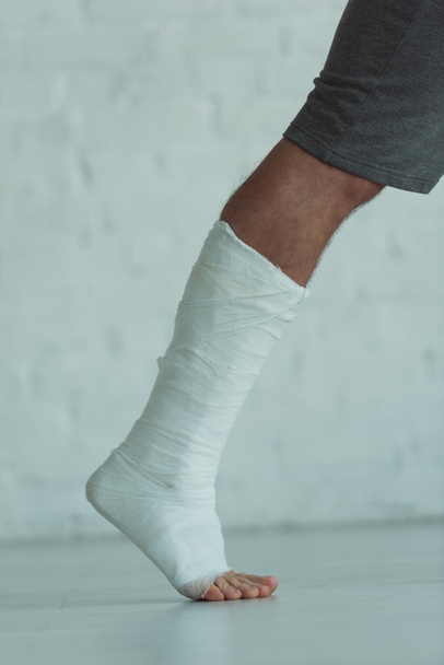 Cropped view of broken leg of man in gypsum - Photo, Image