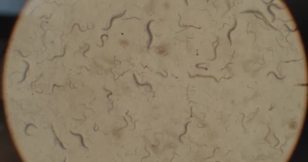 Une colonie de micro-organismes, c-elegans (Caenorhabditis elegans) vers nématodes sous le microscope, se déplaçant dans une boîte de Pétri, macro shot. BMPCC 4K. Biochimie, médecine pharmaceutique, science
   - Séquence, vidéo