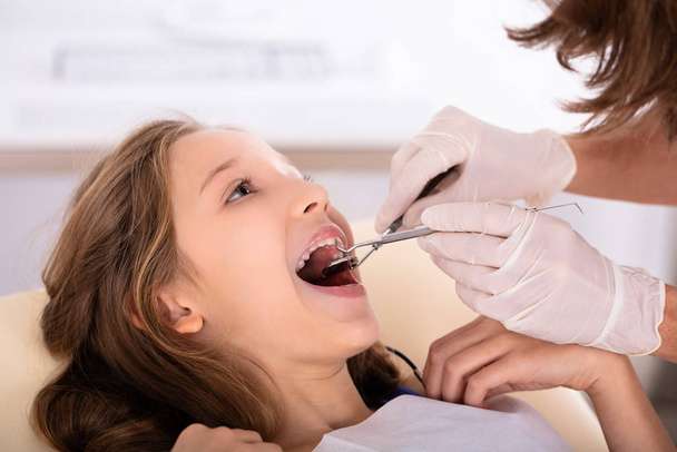 Close-up Of A Girl Going Through Dental Treatment In Clinic - Фото, изображение