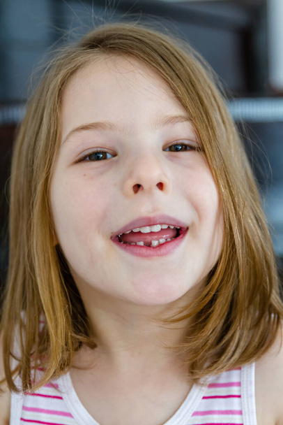 Little cute girl smiling and showing off her first lost milk tooth - Valokuva, kuva