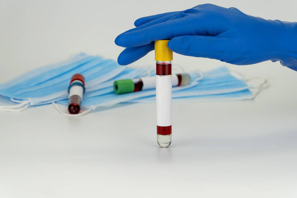 Χέρι κρατώντας δείγμα αίματος σε σωλήνα κενού. Θετικό αποτέλεσμα δοκιμής για τον νέο ταχέως εξαπλούμενο ιό Coronavirus - Φωτογραφία, εικόνα