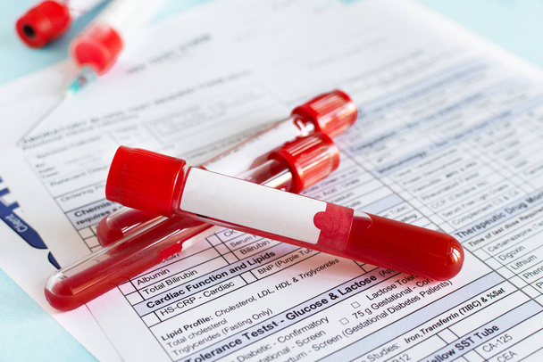 Vial de sangre roja con muestra de sangre sobre el fondo del formulario de prueba
. - Foto, Imagen