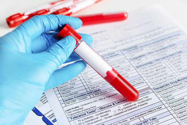 Mano del médico sosteniendo el vial de sangre roja con muestra de sangre y llenando el formulario de prueba con resultados
. - Foto, Imagen