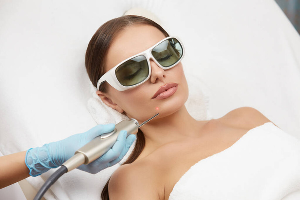 close-up of petty woman receiving laser procedures for her chin wearing protection glasses, beautician arm doing hair removal on customer skin in cosmetology clinic - Photo, Image