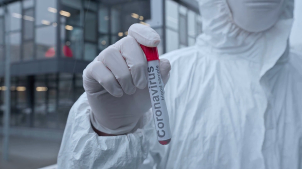 focus pull of asian scientific κρατώντας δείγμα με γράμματα coronavirus  - Πλάνα, βίντεο