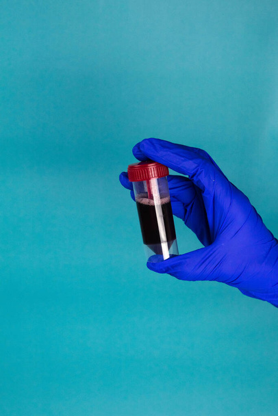 Hand houdt een reageerbuis met bloed vast. Coronavirus 2019-ncov - Foto, afbeelding