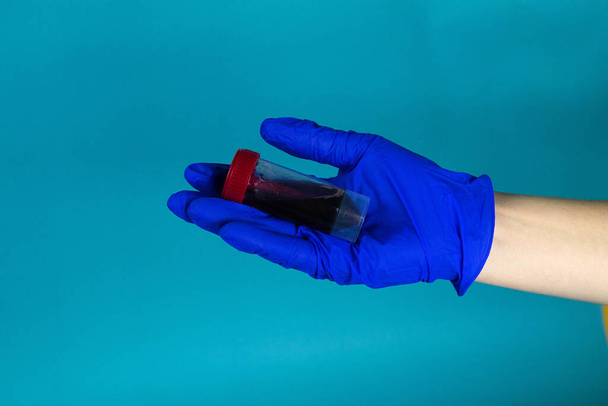 A kéz egy véres kémcsövet tart. Coronavirus 2019-ncov - Fotó, kép