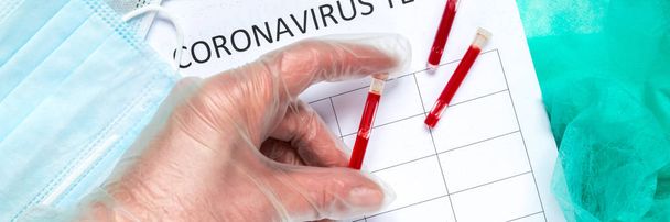 Coronavirus MERS-CoV virus Kiina infektio Virus maski ja verikoeputket virus testi, käsite Kiina virus epidemia Coronavirus nCov
 - Valokuva, kuva