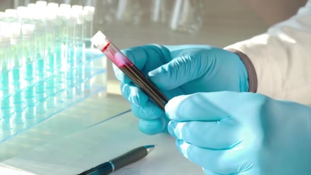 Investigador cuidadosamente mantener una muestra de sangre de tubo de ensayo witn en las manos en guantes de protección
. - Metraje, vídeo