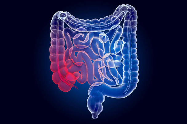 Dolor en los intestinos humanos, concepto de intestino. Efecto de luz fantasma
 - Foto, Imagen