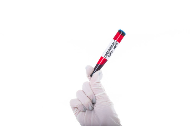 Крупним планом рукавичка, що тримає пробірку, що містить кров нового коронавірусу
 - Фото, зображення