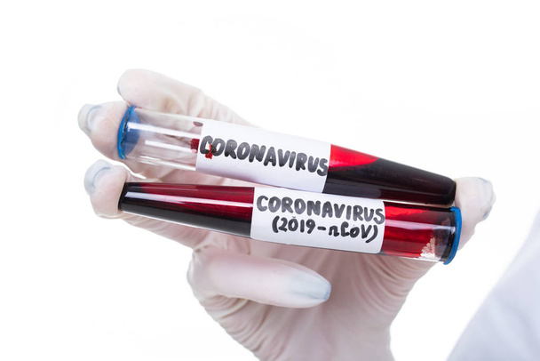 Nahaufnahme einer Hand mit zwei Blutproben, in der das Coronavirus nachgewiesen wurde - Foto, Bild