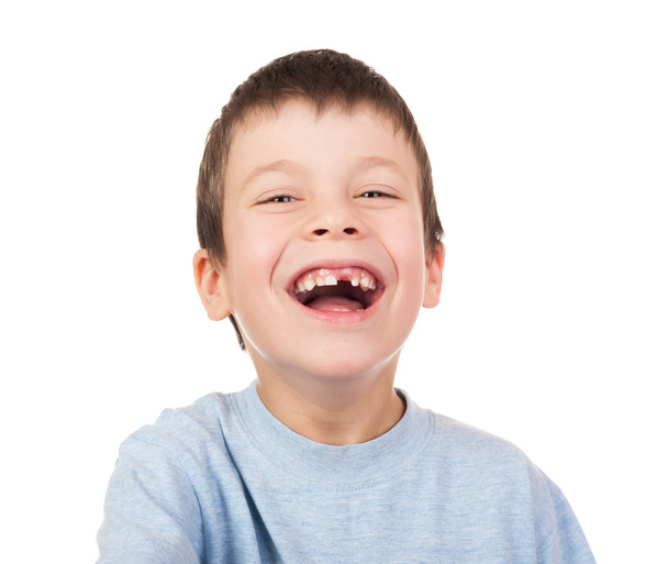 Boy portrait with a lost tooth - Φωτογραφία, εικόνα