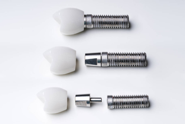 Dental Tooth Implant Parts Over White Background - Φωτογραφία, εικόνα