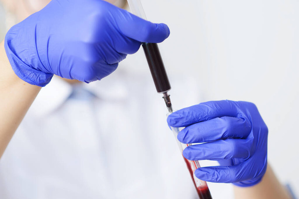  лікар в латексних рукавичках тримає шприц із зразком крові та пробіркою
 - Фото, зображення