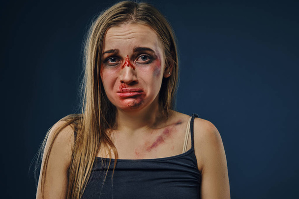 Расстроенная блондинка в черной футболке. Кровоточащее лицо, покрытое синяками, плачущее, позирующее на фоне синей студии. Крупный план
 - Фото, изображение
