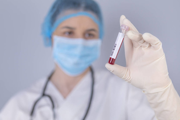 Nurse holding test tube blood sample - Foto, Imagem