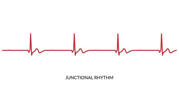 ECG Heartbeat Line. Electrocardiogram vector illustration. Junctional Rhythm - Vektör, Görsel