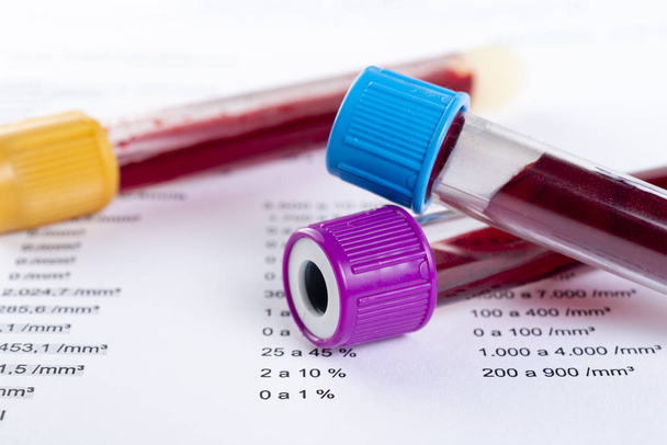 Blood test tube with full blood count in the background. - Photo, Image