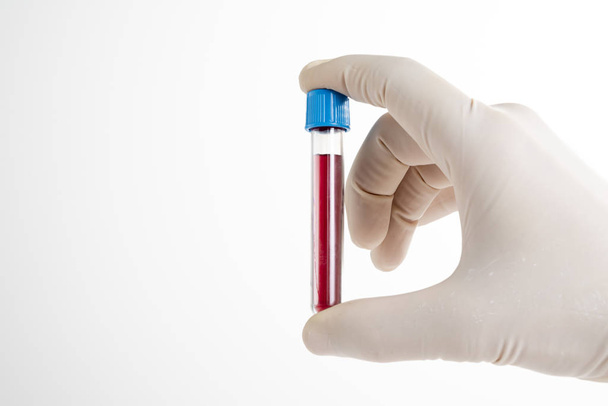Doctor presenting tube with blood for complete blood test. - Photo, Image