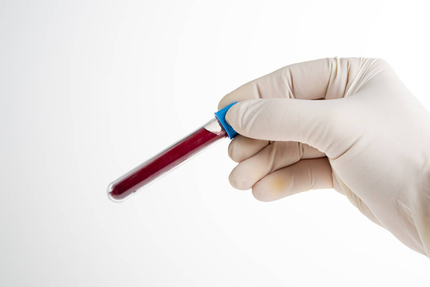 Male nurse holding blood test on white background. Space for text. - Foto, afbeelding