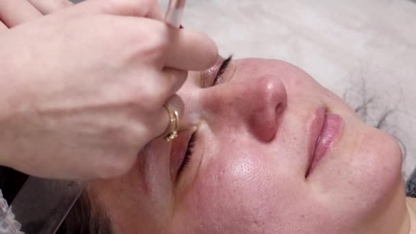 Žena se připravuje na laserovou omlazovací proceduru v salonu. Kosmetolog-dermatolog dokončí zákrok fotorejuvenace. Střelba je z různých úhlů - Záběry, video