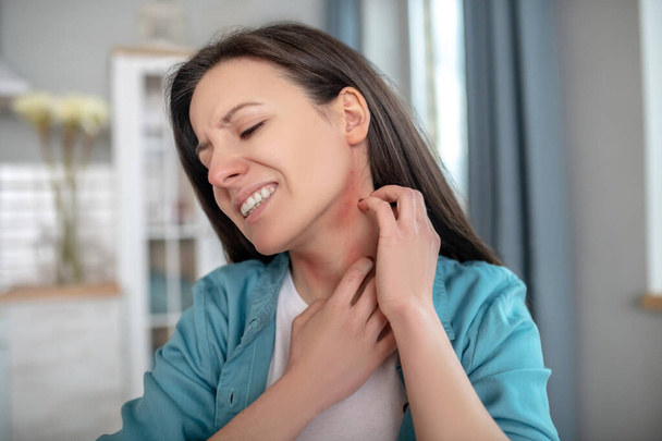 Mulher comichão no pescoço por causa da alergia
 - Foto, Imagem