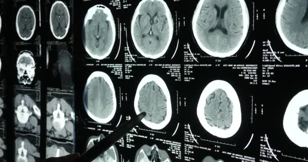 4 k orvosok tanulmány koponya-agy X-ray film analysis.health orvosi Kórház. - Felvétel, videó