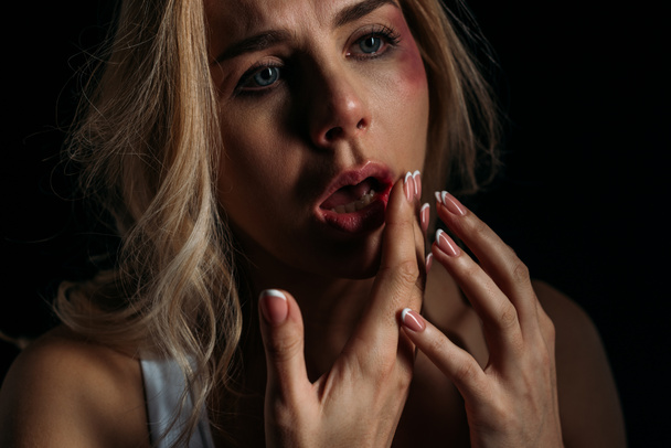 Victim with open mouth and bruises touching lips isolated on black  - 写真・画像