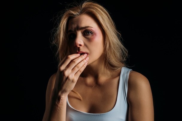 Slachtoffer met blauwe plekken op gezicht kijkend naar camera en aangrijpende lippen geïsoleerd op zwart  - Foto, afbeelding