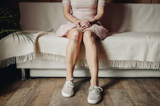 Vista recortada de la mujer con moretones y herida sentada en el sofá en casa
 - Foto, Imagen