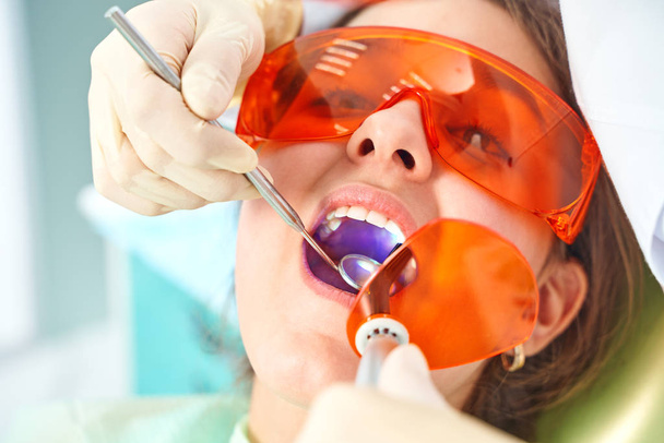Kislány az orvosnál. A fogorvos szájüregbe helyezi a fogtömést fogászati polimerizációs lámpával. klinikai háttér felett - Fotó, kép