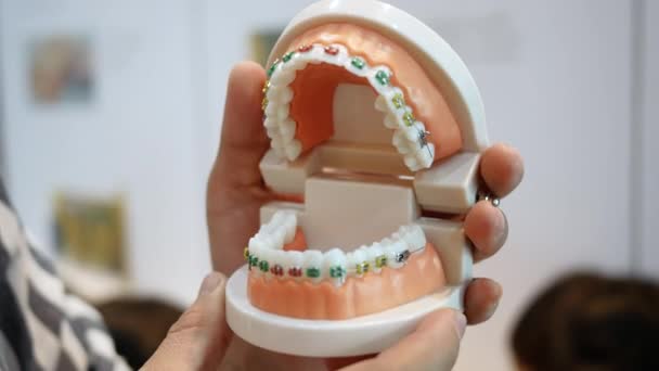 De tandarts houdt kunstgebit in handen en laat zien hoe het systeem van beugels op de tanden is geregeld. Prothetische tandheelkunde concept. - Video