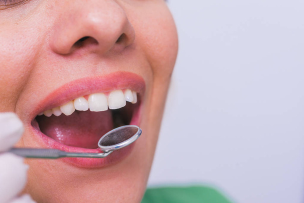 Gros plan d'une patiente à bouche ouverte lors d'un bilan buccal chez le dentiste. - Photo, image