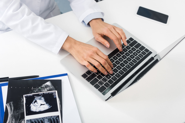 rajattu näkymä ammatillinen lääkäri ultraääni skannaa työskentelevät kannettavan tietokoneen ja älypuhelimen
 - Valokuva, kuva