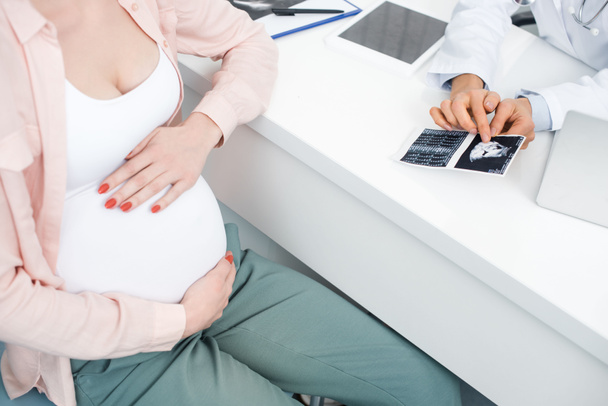 vista cortada do médico mostrando ultra-som para jovem grávida tocando barriga
 - Foto, Imagem