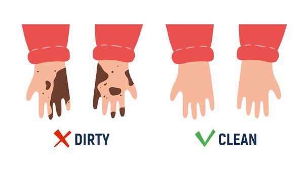 Špinavá a čistá ruka. Hygienický plakát. Izolovaná vektorová ilustrace - Vektor, obrázek