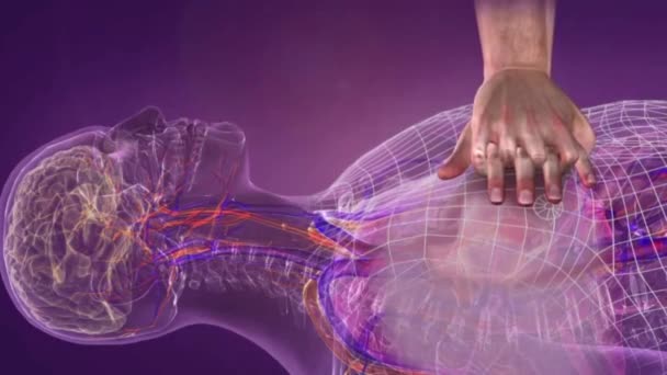 Paina sydäntä ja käynnistä verenkierto uudelleen verenkierron varmistamiseksi sydämen pysähtymisen seurauksena
 - Materiaali, video