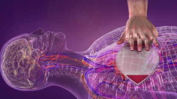 Lääketieteellinen animaatio Basic Life Support, Keinotekoinen hengitys Sydänhieronta
 - Materiaali, video